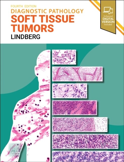 Diagnostic Pathology: Soft Tissue Tumors (Hardcover, 4 ed)