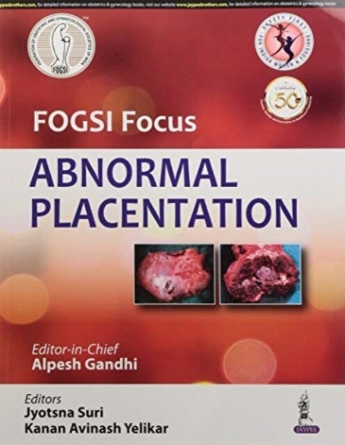 FOGSI Focus Abnormal Placentation (Paperback)