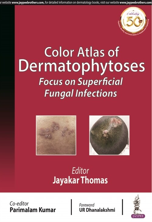 Color Atlas of Dermatophytoses : Focus on Superficial Fungal Infections (Paperback)