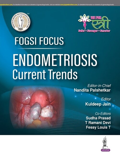 FOGSI Focus Endometriosis: Current Trends (Paperback)