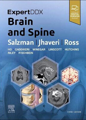 ExpertDDx: Brain and Spine (Hardcover, 3 ed)