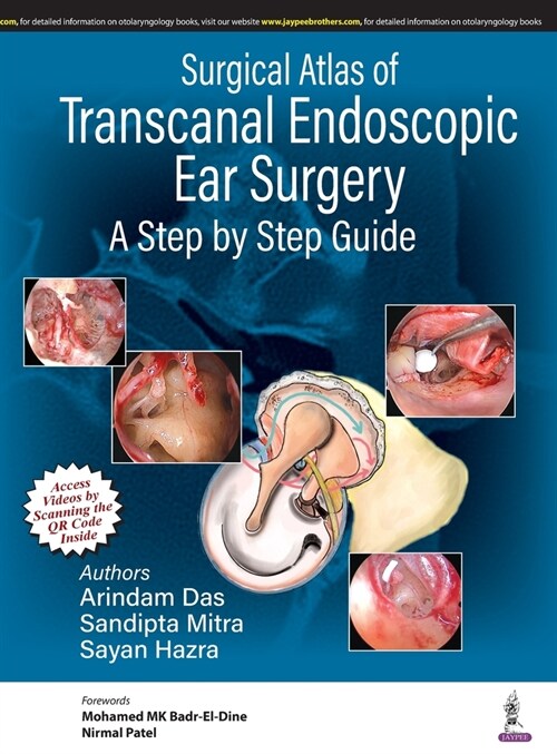 Surgical Atlas of Transcanal Endoscopic Ear Surgery : A Step by Step Guide (Hardcover)