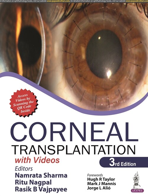 Corneal Transplantation : with Videos (Paperback, 3 Revised edition)