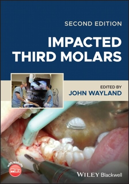 Impacted Third Molars (Hardcover)