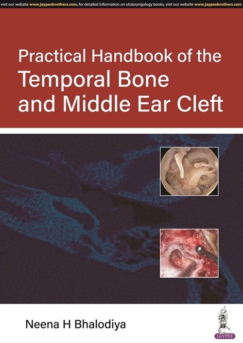 Practical Handbook of the Temporal Bone and Middle Ear Cleft (Paperback)