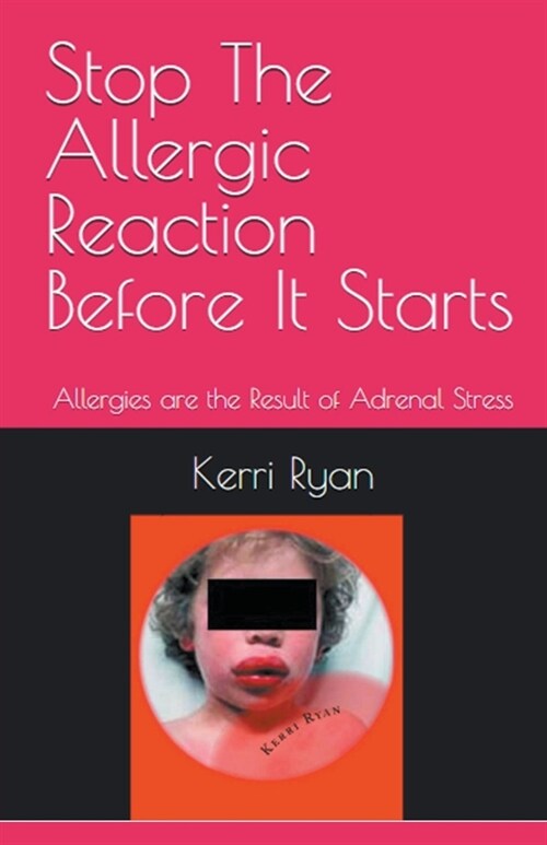 Stop the Allergic Reaction Before It Starts (Paperback)