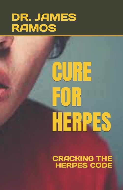 Cure for Herpes: Cracking the Herpes Code (Paperback)