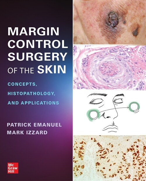 Margin Control Surgery of the Skin: Concepts, Histopathology, and Applications (Paperback)
