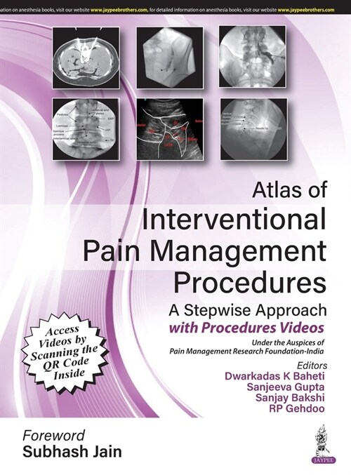 Atlas of Interventional Pain Management Procedures : A Stepwise Approach (Hardcover)