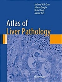 Atlas of Liver Pathology (Hardcover)