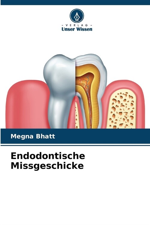 Endodontische Missgeschicke (Paperback)