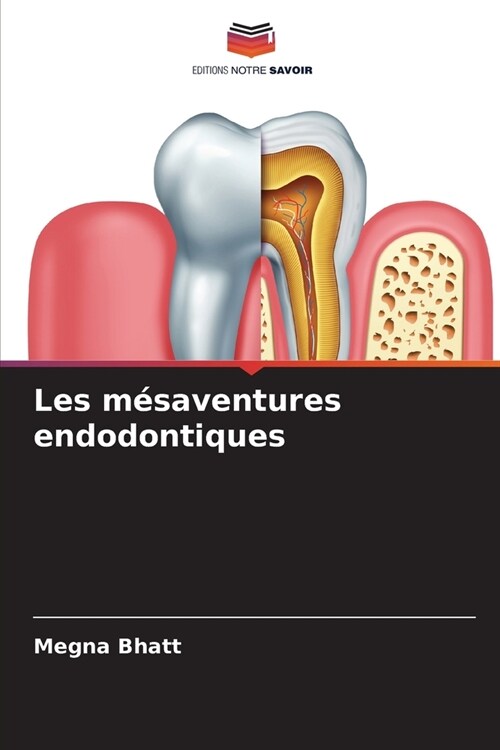 Les m?aventures endodontiques (Paperback)