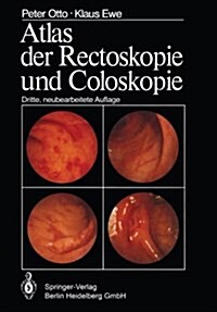 Atlas Der Rectoskopie Und Coloskopie (Paperback, 3, Softcover Repri)