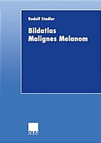 Bildatlas Malignes Melanom (Paperback)