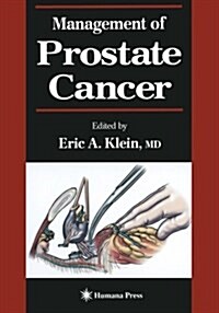 Management of Prostate Cancer (Paperback, Softcover Repri)