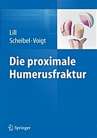 Die Proximale Humerusfraktur (Hardcover, 2014)
