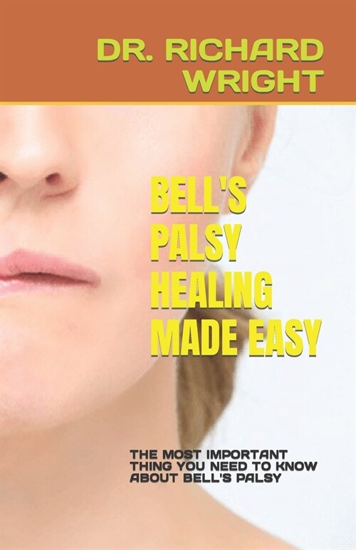 Bells Palsy Healing Made Easy: The Most Important Thing You Need to Know about Bells Palsy (Paperback)