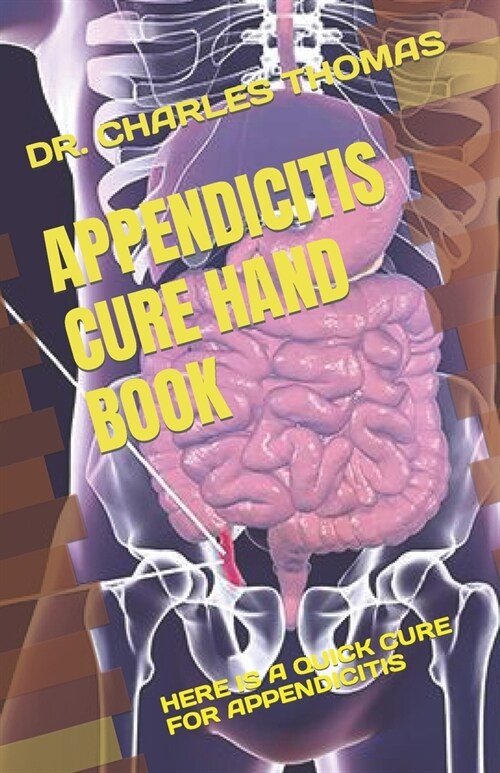 Appendicitis Cure Hand Book: Here Is a Quick Cure for Appendicitis (Paperback)