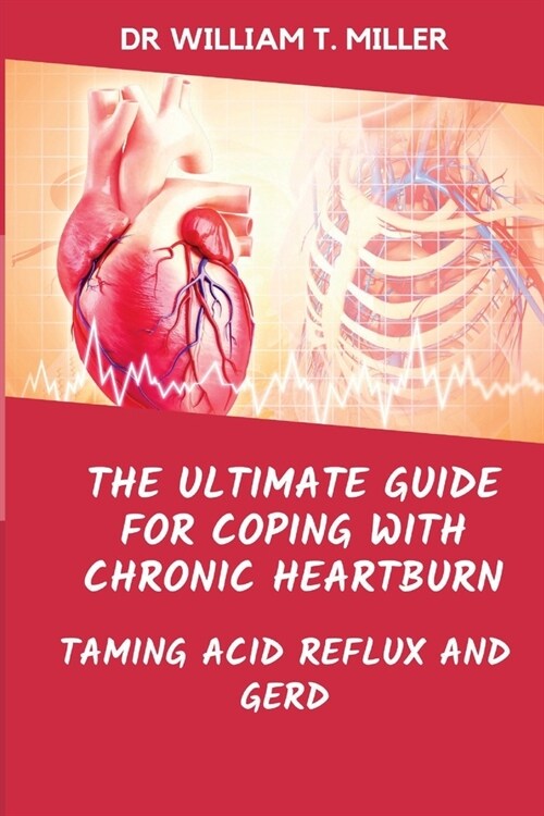 The Ultimate Guide for Coping with Chronic Heartburn: Taming Acid Reflux and Gerd (Paperback)