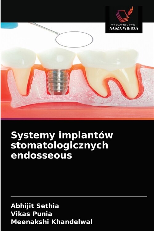 Systemy implant? stomatologicznych endosseous (Paperback)
