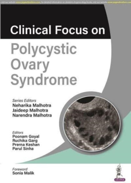 Clinical Focus on Polycystic Ovary Syndrome (Paperback)