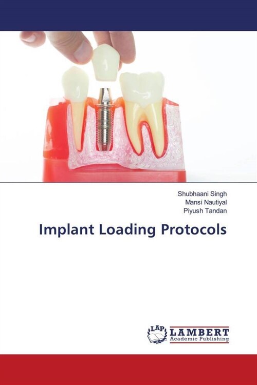 Implant Loading Protocols (Paperback)