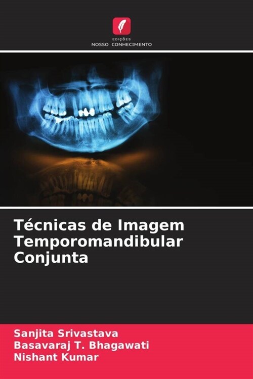 Tecnicas de Imagem Temporomandibular Conjunta (Paperback)