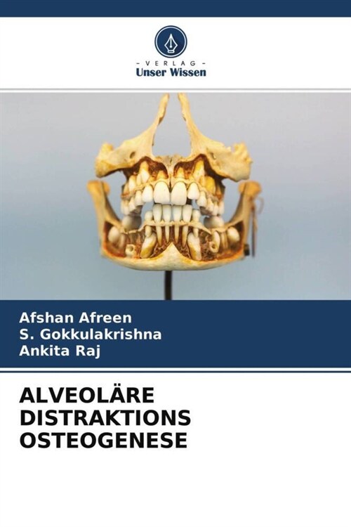 ALVEOLARE DISTRAKTIONS OSTEOGENESE (Paperback)