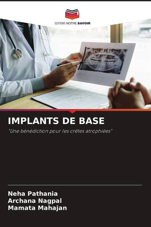 IMPLANTS DE BASE (Paperback)