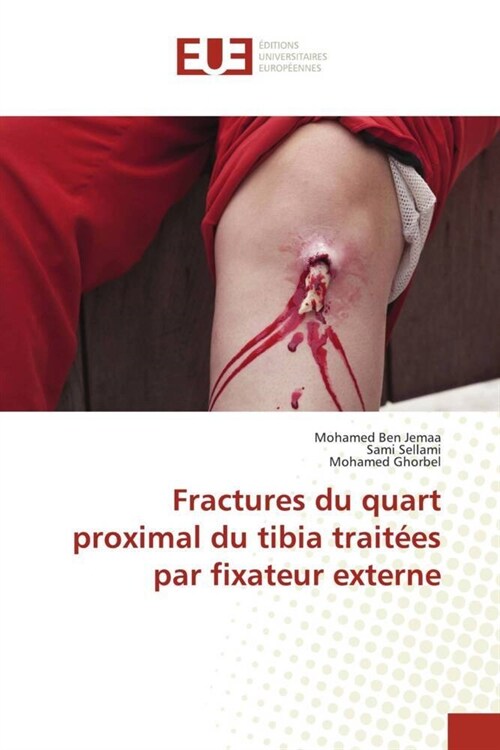 Fractures du quart proximal du tibia traitees par fixateur externe (Paperback)