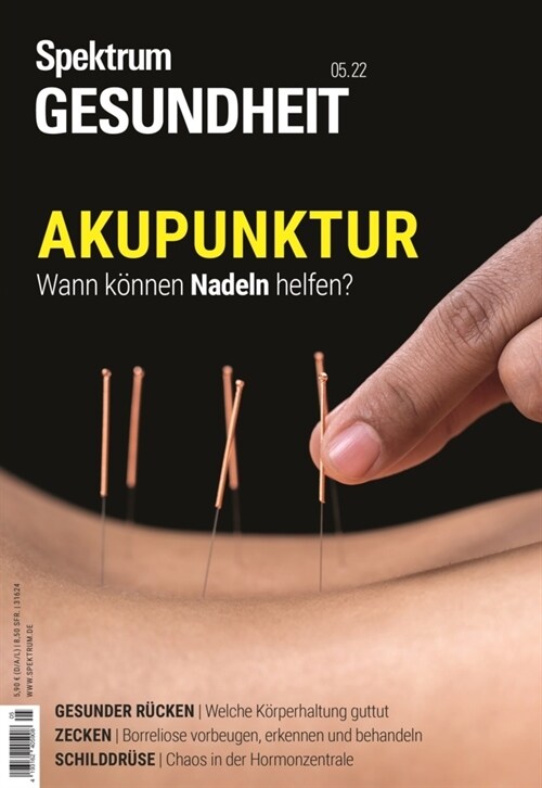 Spektrum Gesundheit- Akupunktur (Book)
