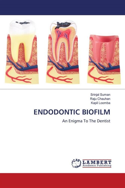 ENDODONTIC BIOFILM (Paperback)