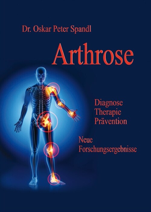 Arthrose (Hardcover)