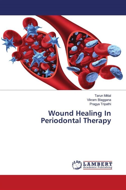 Wound Healing In Periodontal Therapy (Paperback)