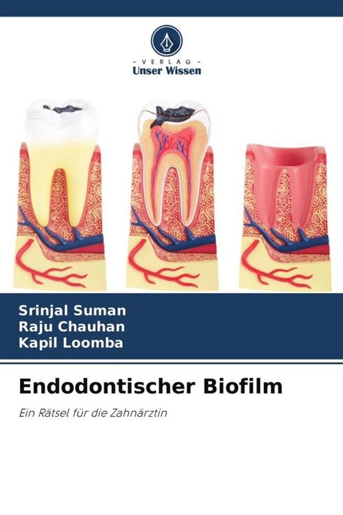 Endodontischer Biofilm (Paperback)