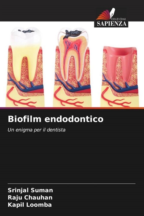 Biofilm endodontico (Paperback)