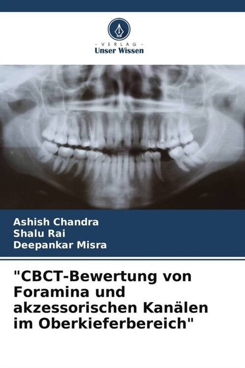 CBCT-Bewertung von Foramina und akzessorischen Kanalen im Oberkieferbereich (Paperback)