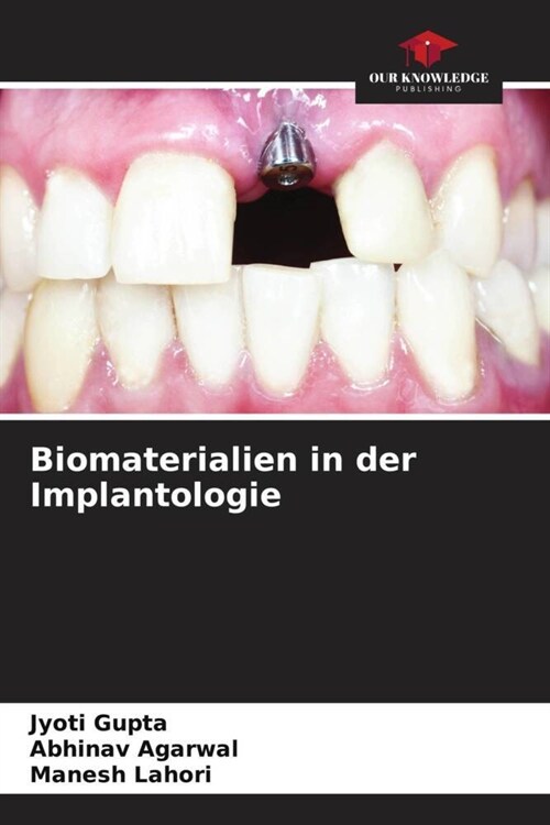 Biomaterialien in der Implantologie (Paperback)