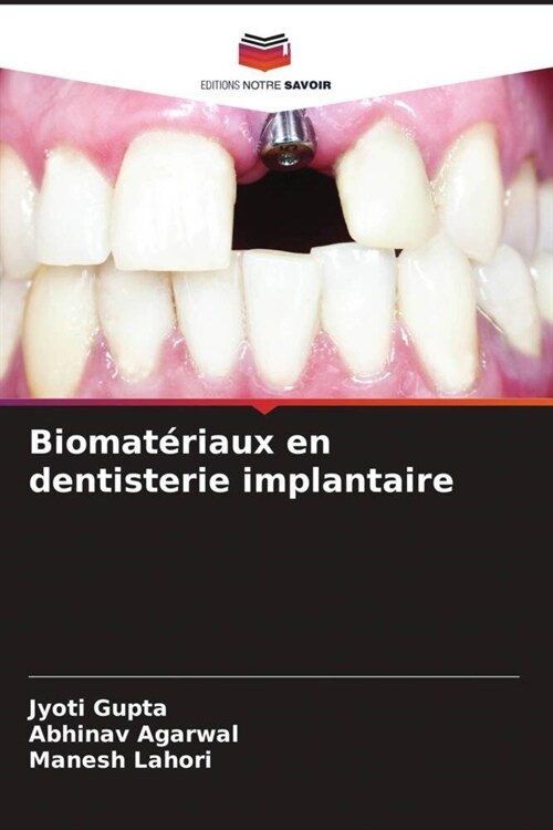 Biomateriaux en dentisterie implantaire (Paperback)