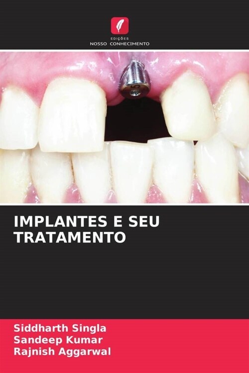 IMPLANTES E SEU TRATAMENTO (Paperback)