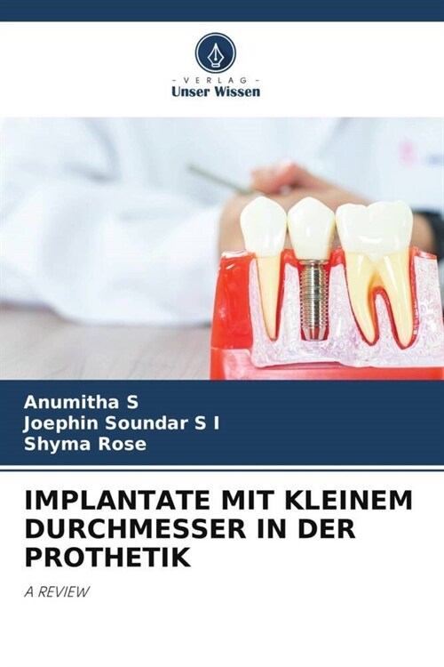 IMPLANTATE MIT KLEINEM DURCHMESSER IN DER PROTHETIK (Paperback)