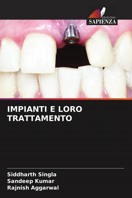 IMPIANTI E LORO TRATTAMENTO (Paperback)