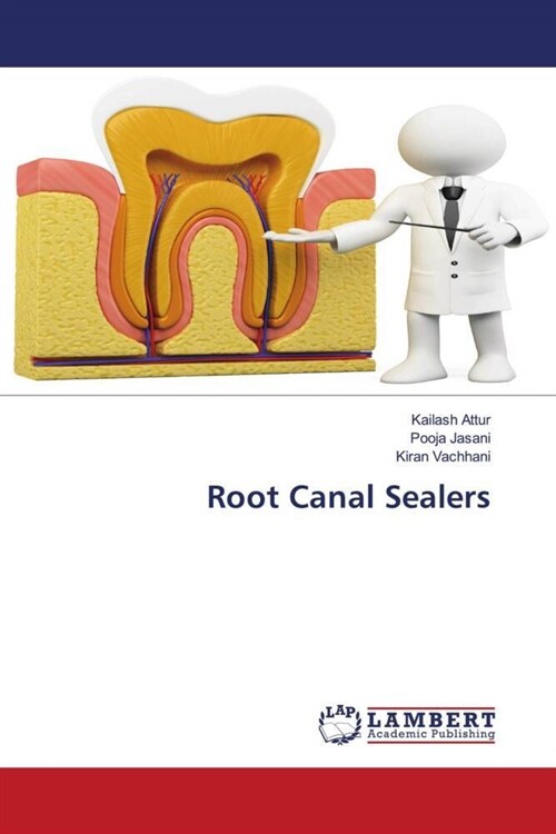 Root Canal Sealers (Paperback)