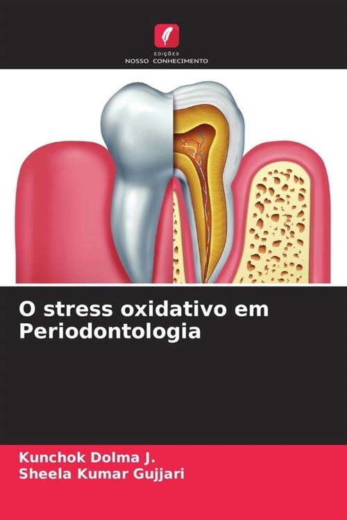 O stress oxidativo em Periodontologia (Paperback)