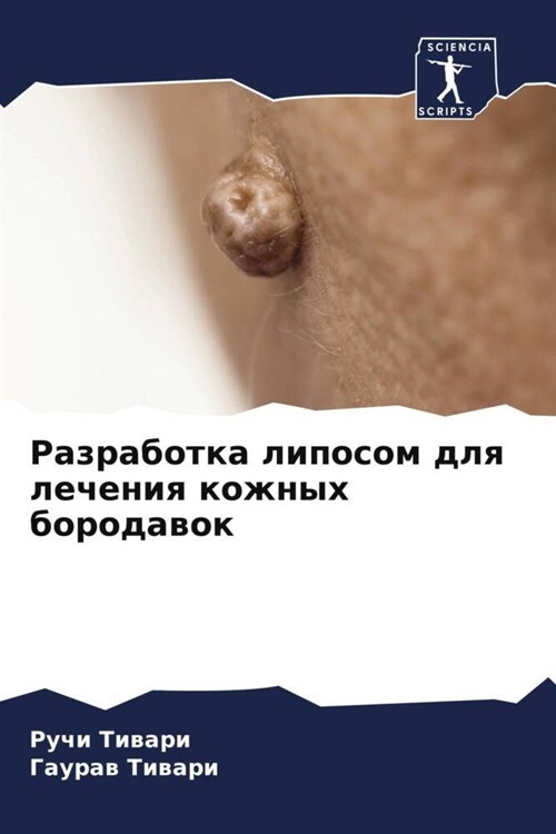 Razrabotka liposom dlq lecheniq kozhnyh borodawok (Paperback)