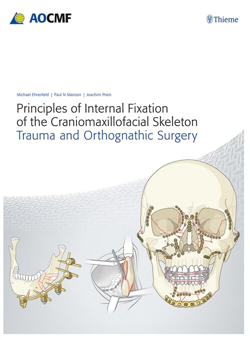 Principles of Internal Fixation of the Craniomaxillofacial Skeleton: Trauma and Orthognathic Surgery (Hardcover)