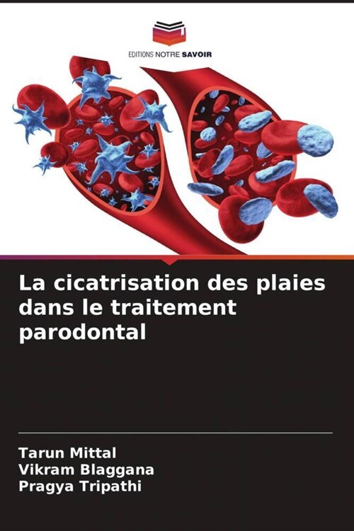 La cicatrisation des plaies dans le traitement parodontal (Paperback)