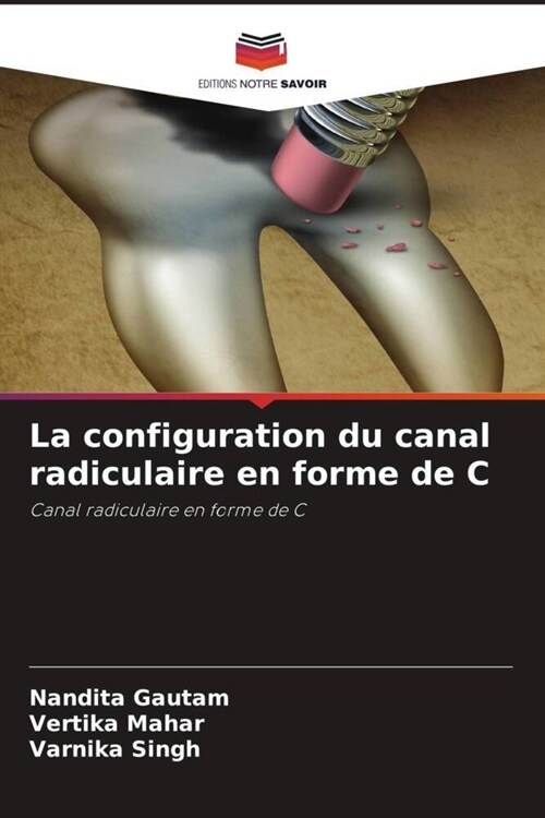 La configuration du canal radiculaire en forme de C (Paperback)