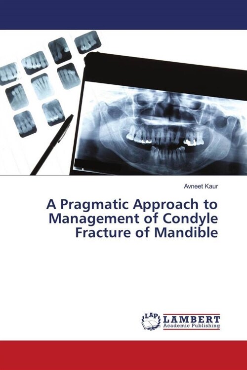 A Pragmatic Approach to Management of Condyle Fracture of Mandible (Paperback)