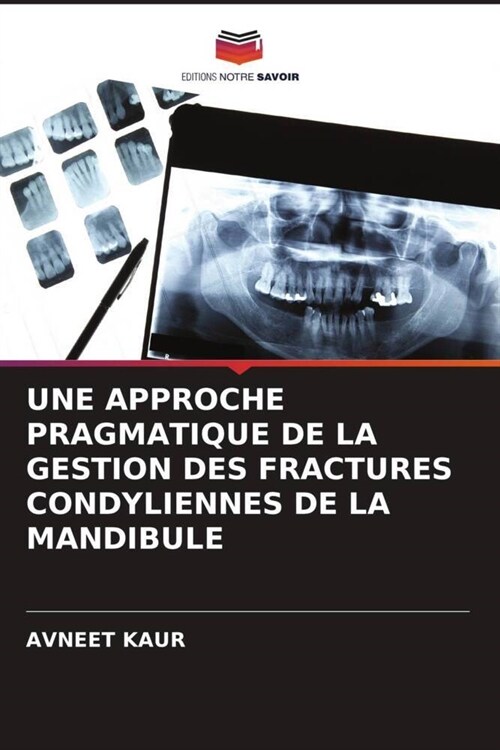 UNE APPROCHE PRAGMATIQUE DE LA GESTION DES FRACTURES CONDYLIENNES DE LA MANDIBULE (Paperback)